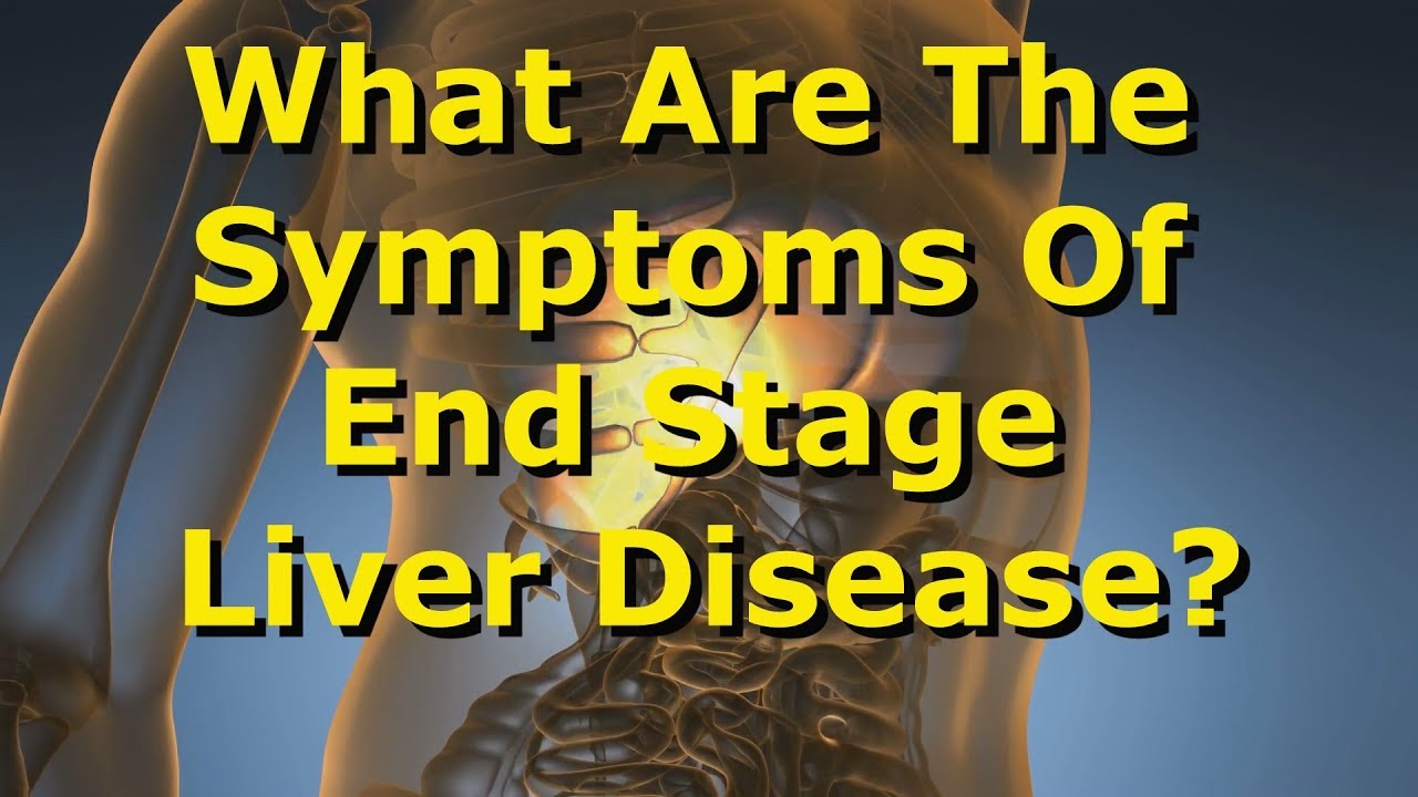 What Are The Symptoms Of End-Stage Liver Disease? - Youtube
