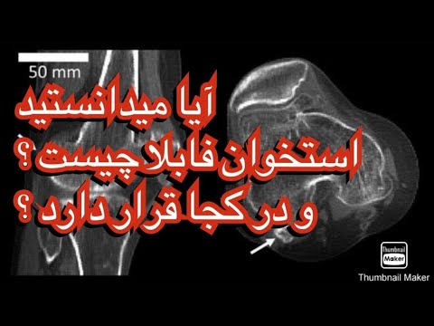 تصویری: مفصل در کجا قرار دارد؟