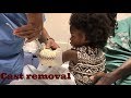 Toddler removes cast: Healing from a broken arm by: Beautiishername