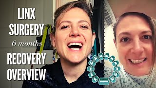 LINX Surgery - 6 Months Recovery Overview | SEE VIDEO UPDATE LINK ↓