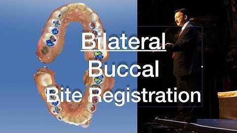 Bilateral Buccal Bite Registration for the Chairside CEREC Software