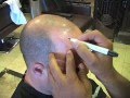 Micro Hair Pigmentation Demonstration - by Los Angeles Hair (Tamir Melamed)