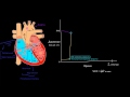 Давление в левых отделах сердца. Часть 1