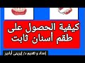 كيفية الحصول على طقم أسنان ثابت د إيريني أبادير الأسنان Denture 