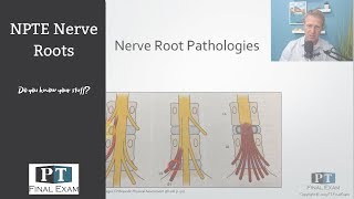 Spinal Pathologies and Discs on the NPTE