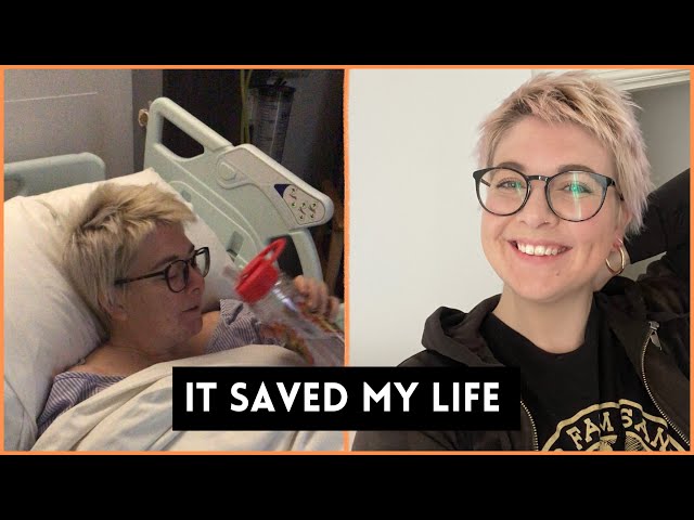 WHY I HAD LIFE CHANGING SURGERY | PMDD