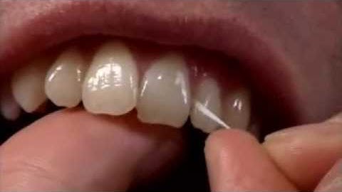 Flossing