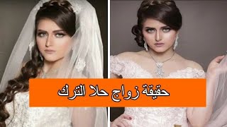 حقيقة وفاة حلا الترك وحقائق لاتعرفها عنها