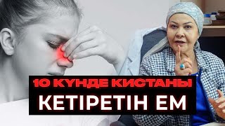 Мұрындағы кистаны 10 күнде қалай жоқ қылдым? | Үй емі