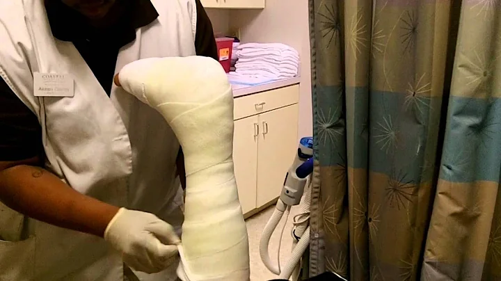 Nicks Cast