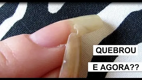 O que fazer para recuperar unha?