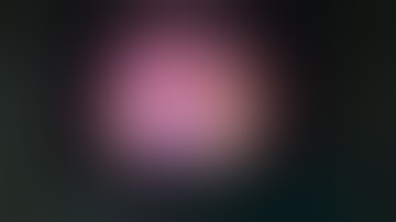 laparoscopic excision o f GIST in the Lesser curvature of stomach