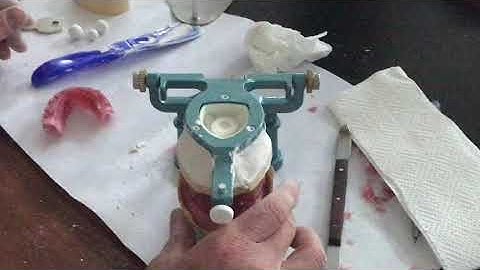 Mounting on Articulator for Complete Denture - part 2