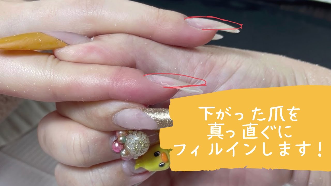 下がって伸びる爪を真っすぐに持ち上げるフィルイン