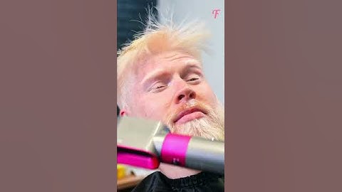 Albino Transformation: Love at First Sight #shorts