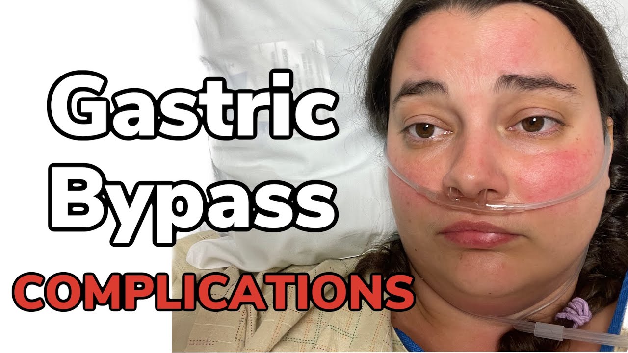 GASTRIC BYPASS COMPLICATIONS FIRST WEEK POST OP YouTube GASTRIC BYPASS COMPLICATIONS FIRST WEEK POST OP YouTube