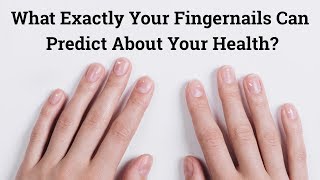 What Exactly Your Fingernails Can Predict About Your Health?