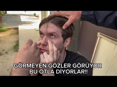 KIRLANGIÇ OTU DENEDİM! GÖZLÜKLERE SON MU? (Çok acı içerir)