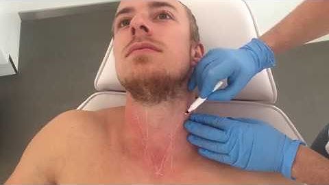 Dr Gabriel Siquier teaching Profhilo BAP Neck at Dameto Clinics International