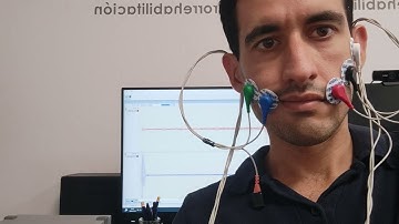 Facial palsy: EMG biofeedback system to retrain zigomaticus major muscle (smile)