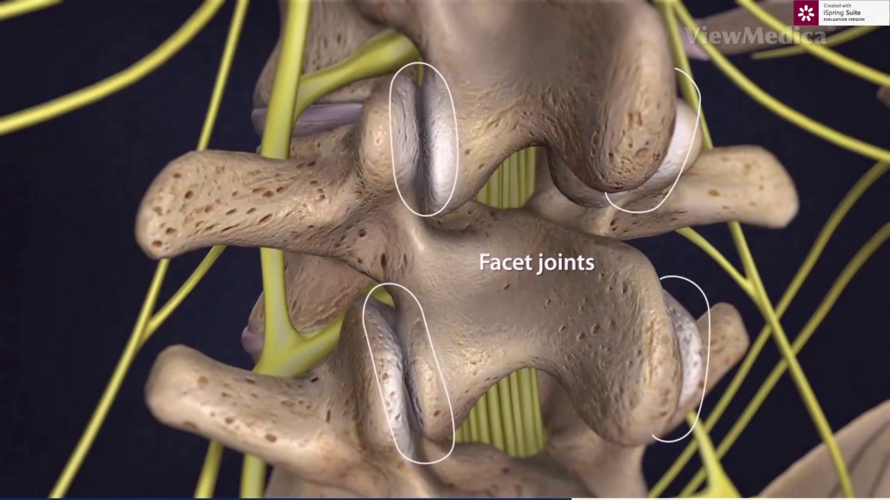 Hernia spinală și hernia de disc în detaliu, într-un limbaj simplu - Gerincfórum