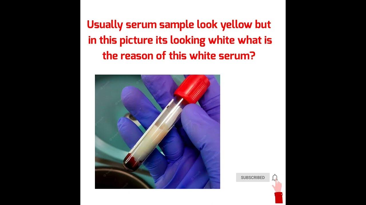 LAB TECHNICIAN QUESTION ANSWERLAB TECHNICIAN MCQSLAB TECHNICIAN