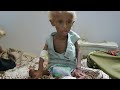 Starving Yemen | Trailer | Available Now