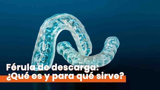 Clínica Dental Figueras - Férula de Descarga: ¿Qué es y para qué sirve? Clínica Dental Figueras - Férula de Descarga: ¿Qué es y para qué sirve?
