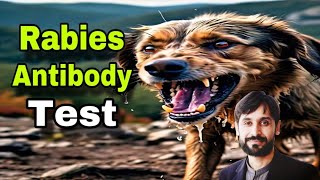 Rabies Antibody Test | MLT Hub with kamran