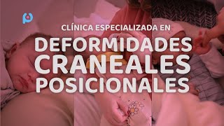 Plagiocefalia Argentina - Video Institucional