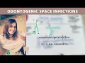 space infection in mandible I  oral surgery lecture