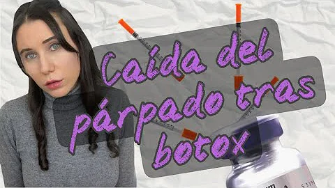 ¿Cuánto dura la caída de las cejas después del Botox?