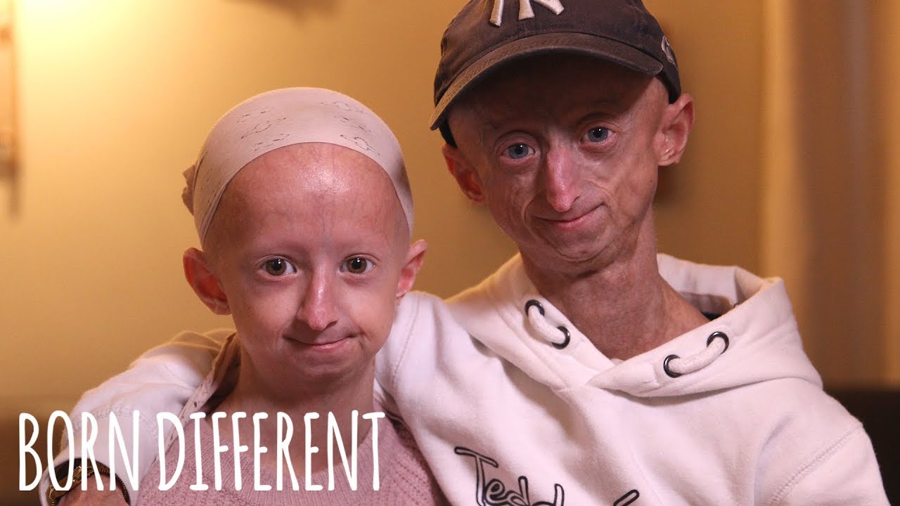The Brother And Sister Who Age Too Fast | BORN DIFFERENT