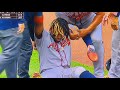 Ronald acua jr injury torn acl acl tear slow motion atlanta braves vs pittsburgh pirates