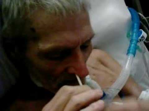 Patient changes NG Feeding tube - YouTube