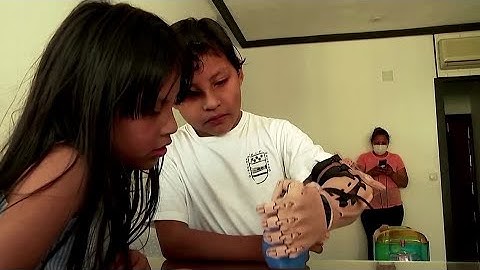 Spanish inventor crafts 3D-printed, prosthetic arms
