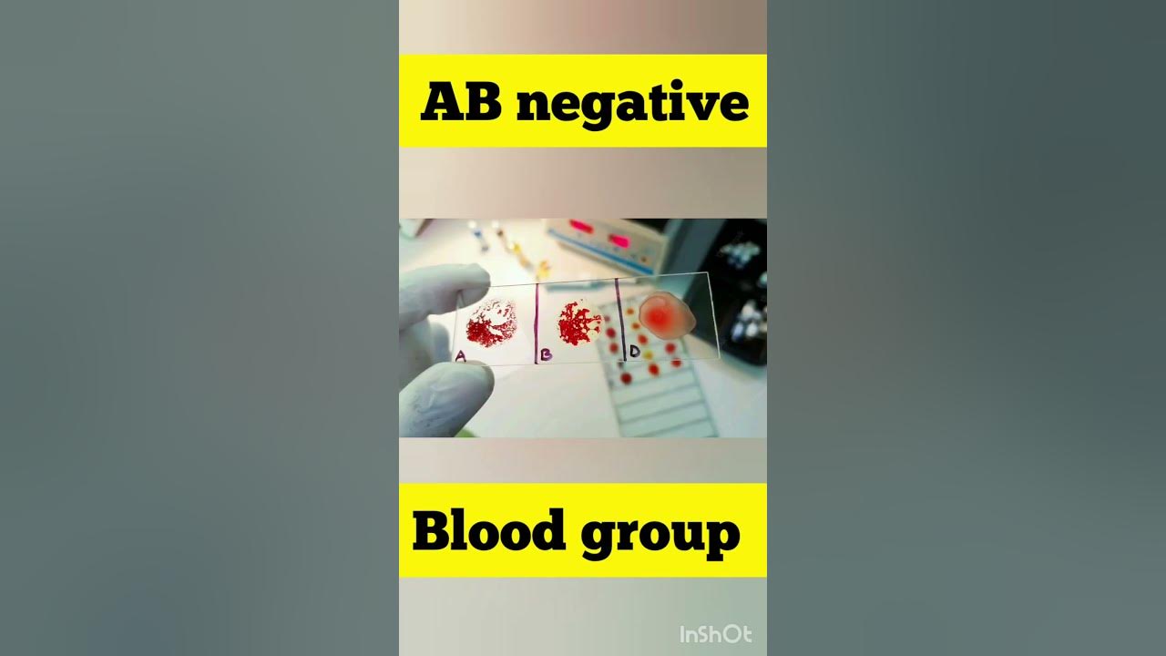abo-blood-group-ab-negative-blood-group-shorts-dayinthelife