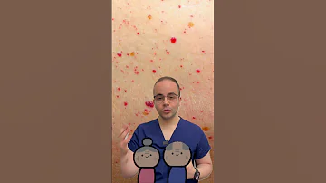 Cherry Angioma Hemangioma Campbell De Morgan Spots ورم وعائي كرزي 