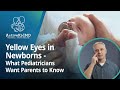 Yellow Eyes In Newborns What Pediatricians Want Parents To Know 