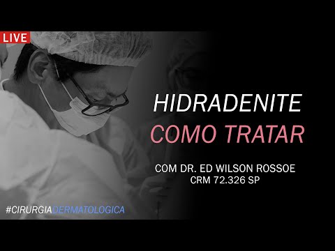 Vídeo: Gatilhos De Hidradenite Supurativa: Dieta, Clima E Muito Mais