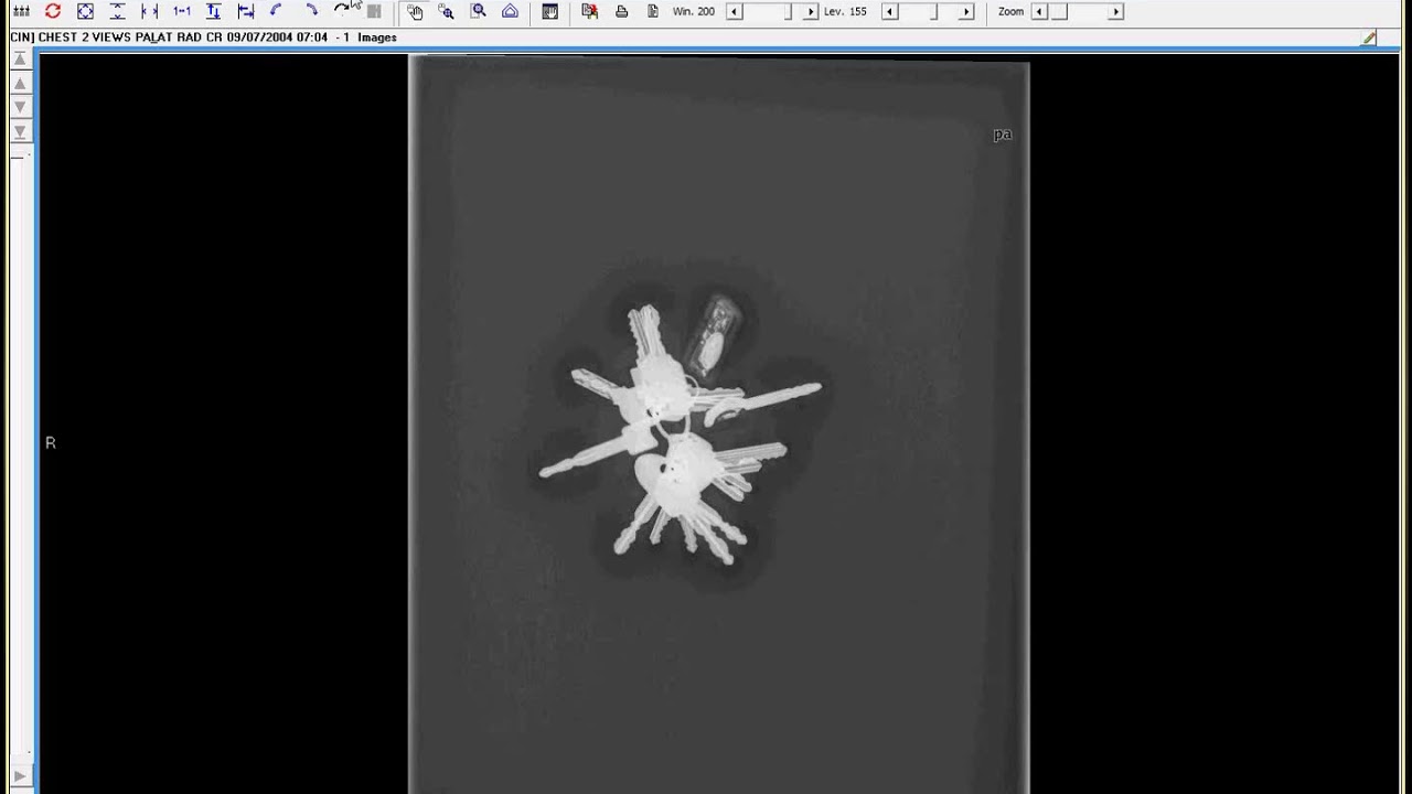 CPRS tips and tricks Imaging plus side by side review - YouTube