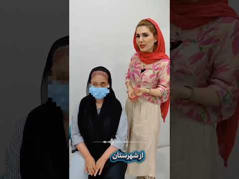 کاشت موی پیشونی خانم چالشی که ما حلش کردیم سلامتمو کاشتمو کاشت پیشانی  کاشت ابرو