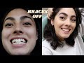 WATCH ME GET MY BRACES OFF VLOG + surprising my family & friends