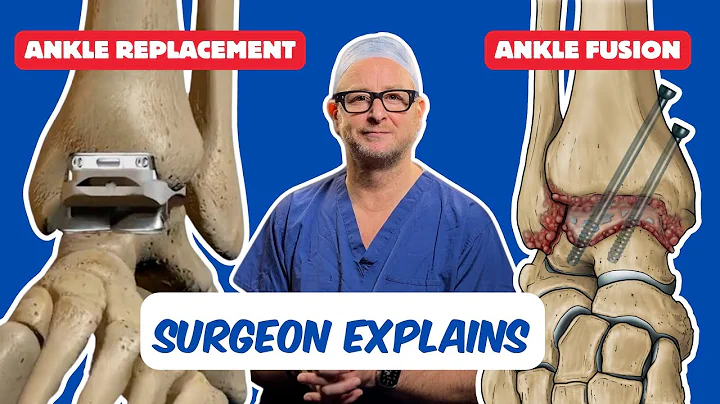 Which is better, an ankle replacement or an ankle fusion?