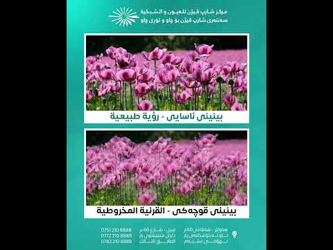 بینینی نەخۆشانی هاوێنه ی قوچه كی نظر مرضی القرنية المخروطية