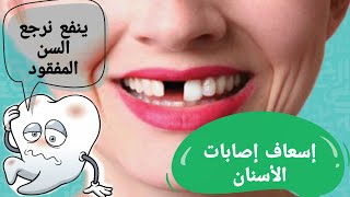 ينفع ترجع السن المفقود ?/ تعمل ايه لو سنتك وقعت / الإسعافات الأولية لإصابات الأسنان / بالطو وسماعة