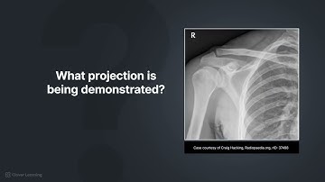 How to Recognize Key Anatomy on Shoulder Radiographs