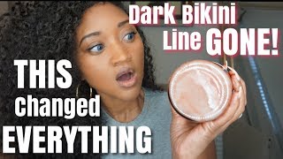 How To Lighten Dark Bikini Line For GOOD! No more dark spots.100% works. *Works on dark armpits*