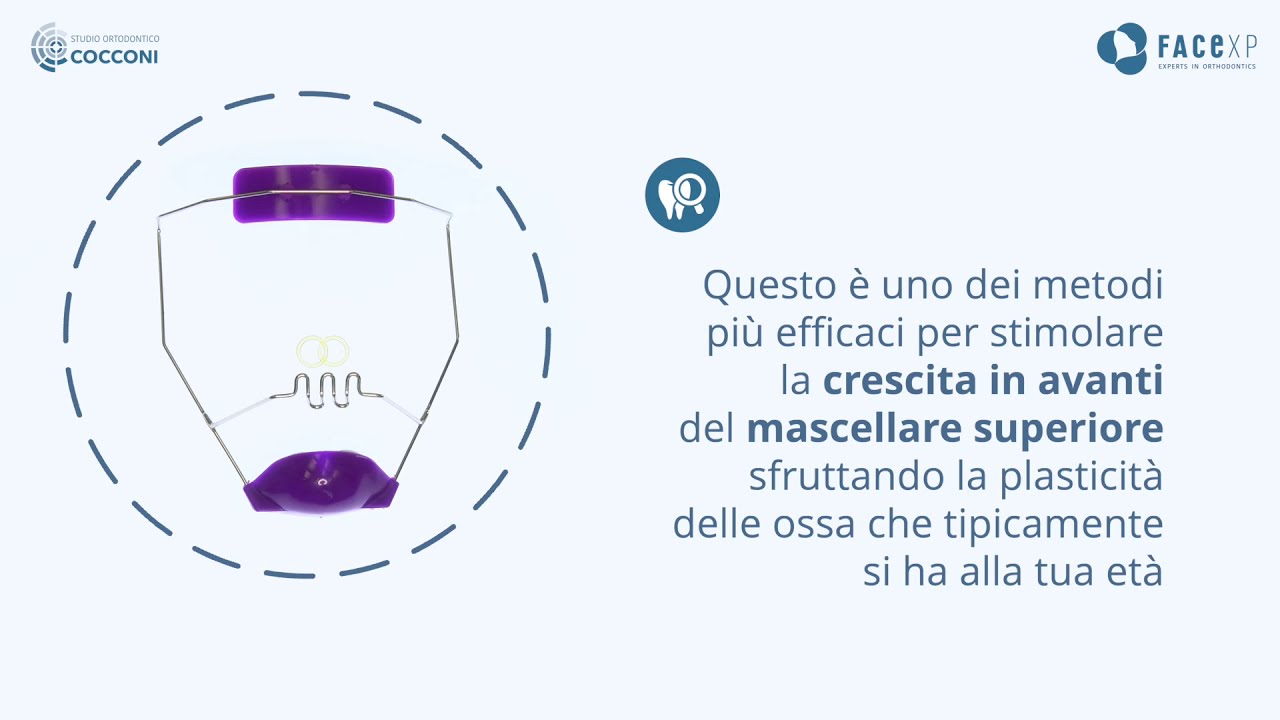 Come indossare la Maschera di Delaire Studio Ortodontico Cocconi Rapa YouTube Come indossare la Maschera di Delaire Studio Ortodontico Cocconi Rapa YouTube