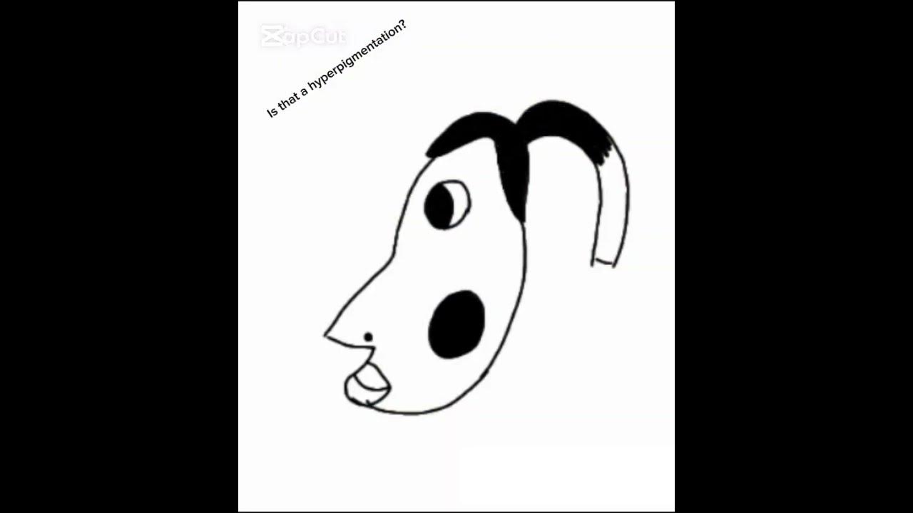 Drawing that hyperpigmentation meme art istthathyperpigmentation 